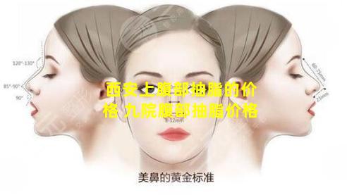 西安上腹部抽脂的价格 九院腹部抽脂价格